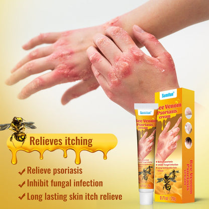 Summifun - Bee Venom Psoriasis Cream-0Summifun Cream